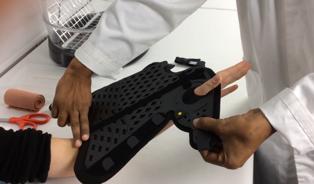 FastForm Orthosis