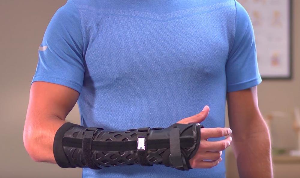 FastForm® Splint Cast Brace – Breg, Inc.